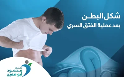 كيف يصير شكل البطن بعد عملية الفتق السري؟