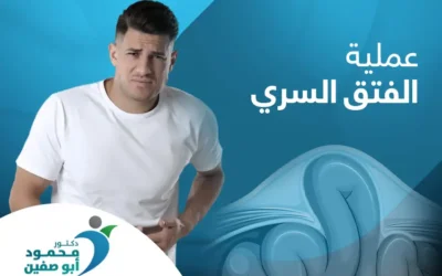 عملية الفتق السري| كيفية الإجراء ومرحلة التعافي