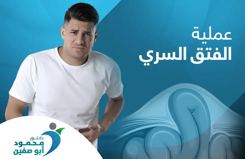 عملية الفتق السري