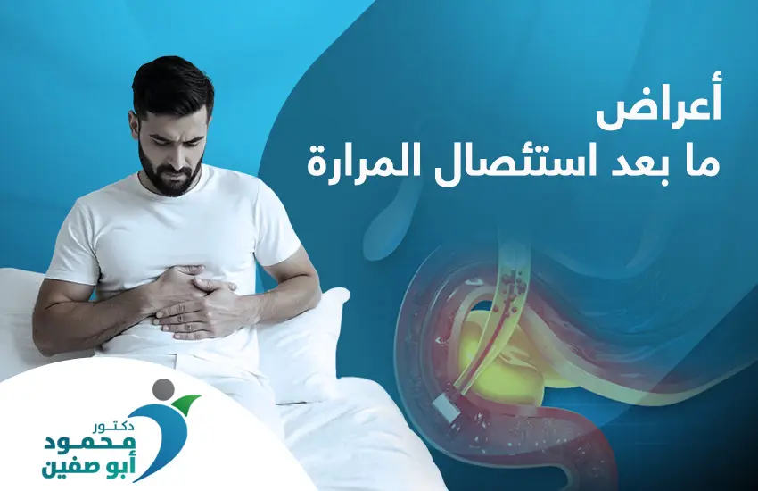 أعراض ما بعد استئصال المرارة