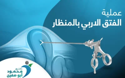 عملية الفتق الإربي بالمنظار: من أول الاستعداد إلى التعافي الكامل