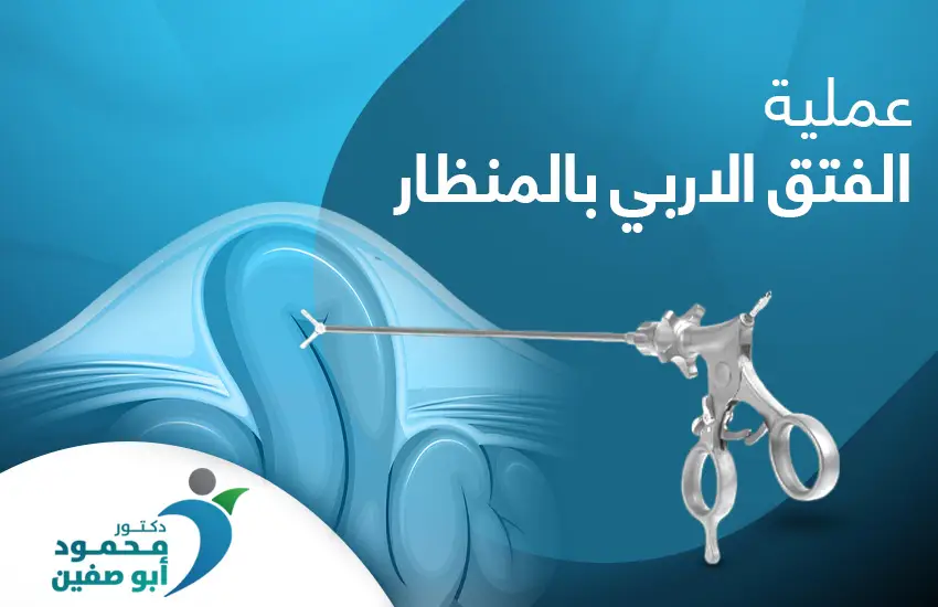 عملية-الفتق-الاربي-بالمنظار عملية الفتق الإربي بالمنظار