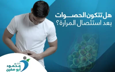 هل تتكون الحصوات بعد استئصال المرارة؟