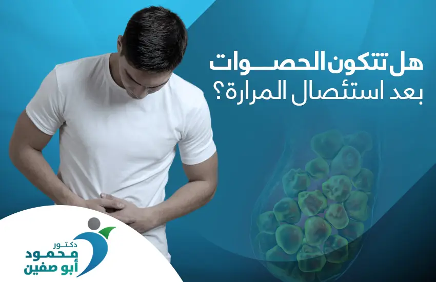 هل تتكون الحصوات بعد استئصال المرارة