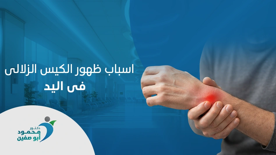 اسباب ظهور الكيس الزلالي في اليد