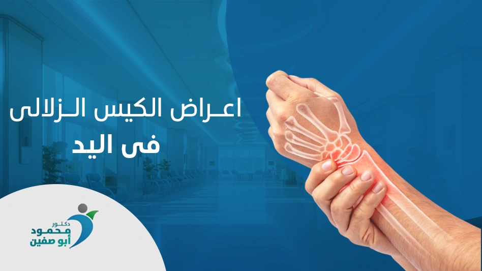 اعراض-الكيس-الزلالى-فى-اليد أعراض الكيس الزلالي في اليد