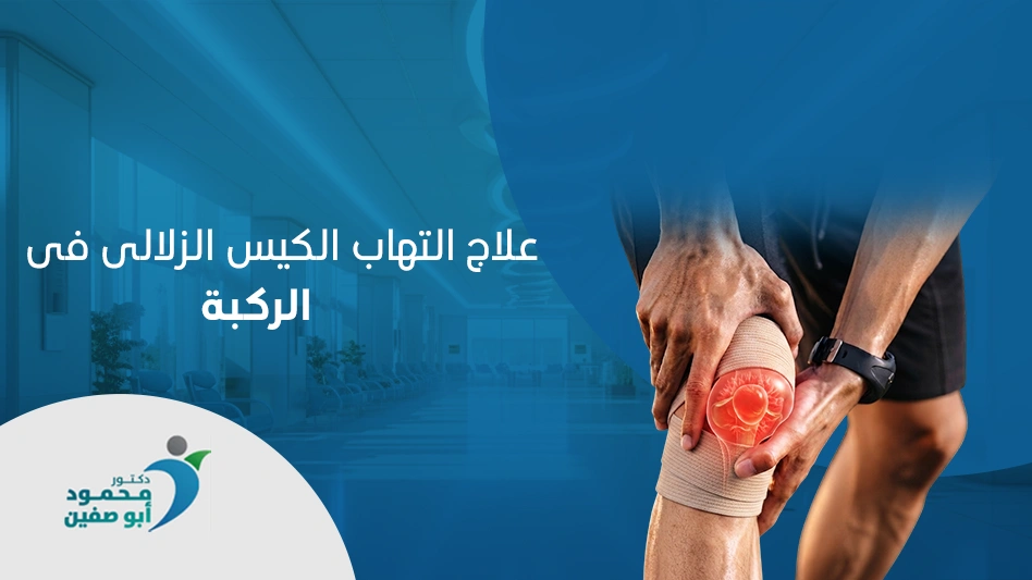 علاج التهاب الكيس الزلالي في الركبة