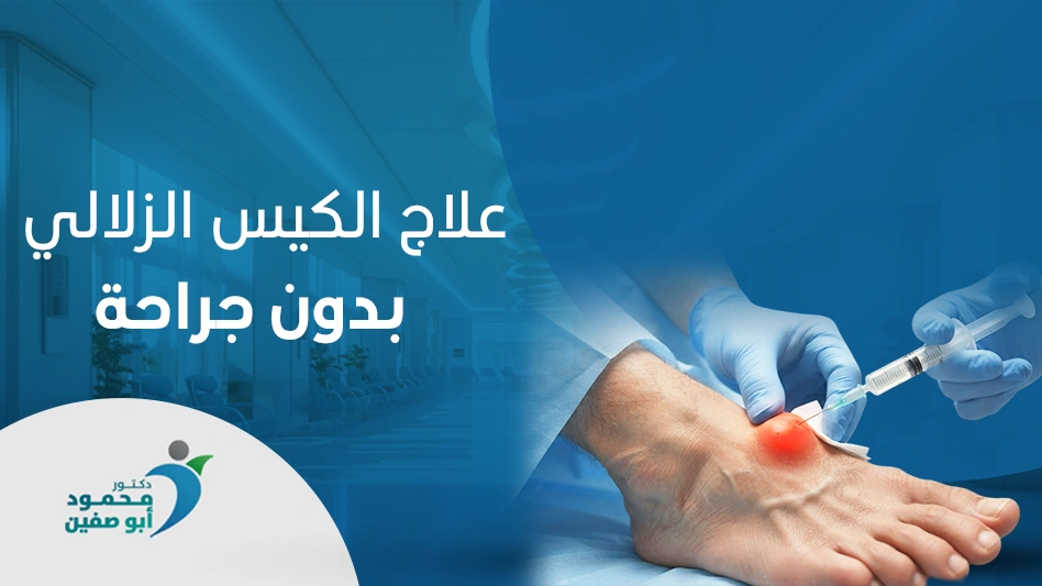  علاج الكيس الزلالي بدون جراحة