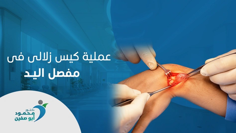 عملية كيس زلالي في مفصل اليد