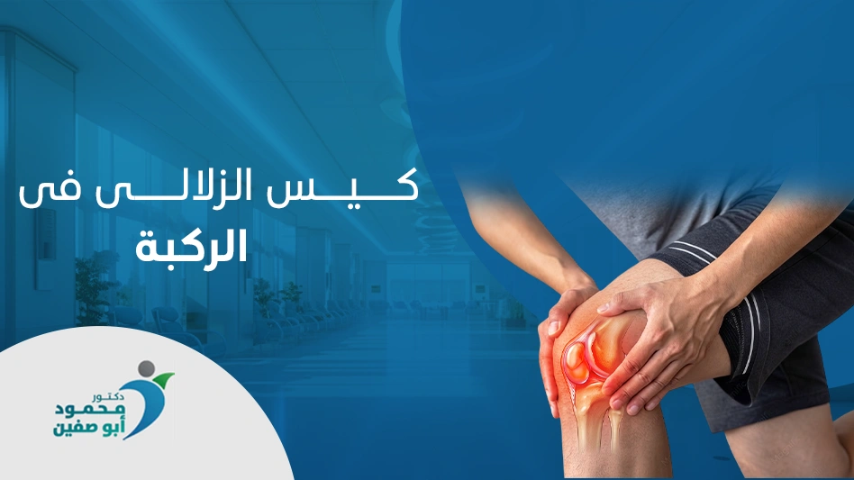 كيس زلالي في الركبة