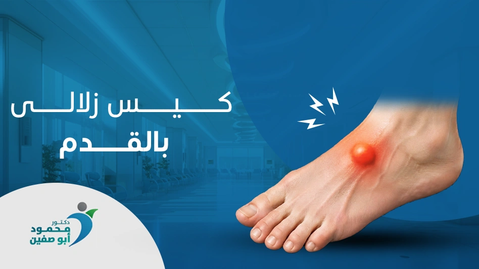 كيس زلالي بالقدم
