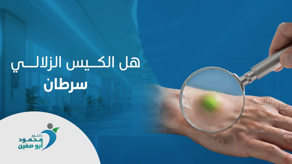  هل الكيس الزلالي سرطان
